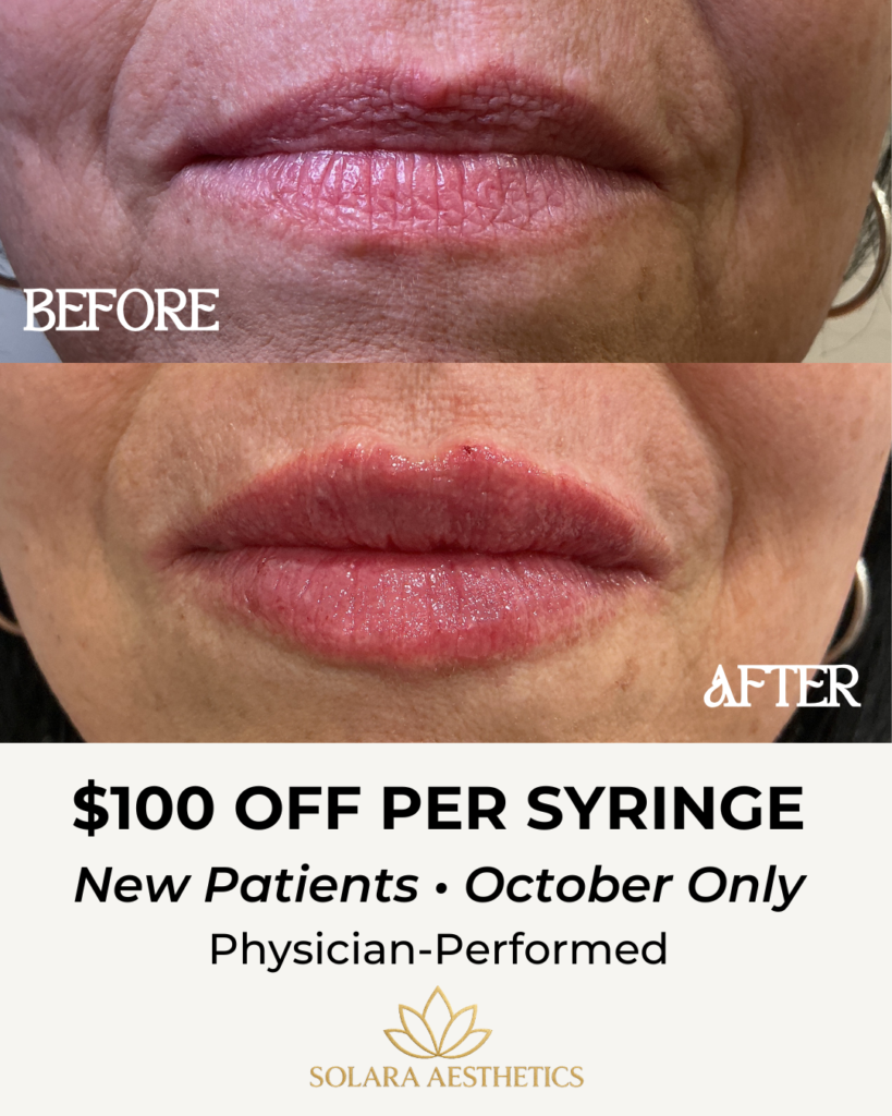 New Patients Filler Treatment 1 FillerAd Meta 1790824208